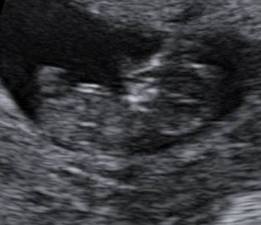 1170842_10153064736595012_560031633_n